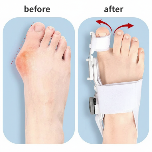 Vitality i Wellness™ Bunion Relief